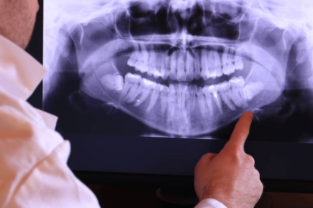 Best Emergency Broken Tooth Repair in Lakeview, OH