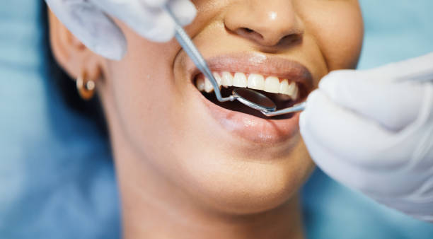Best After-Hours Emergency Dentist in Lakeview, OH